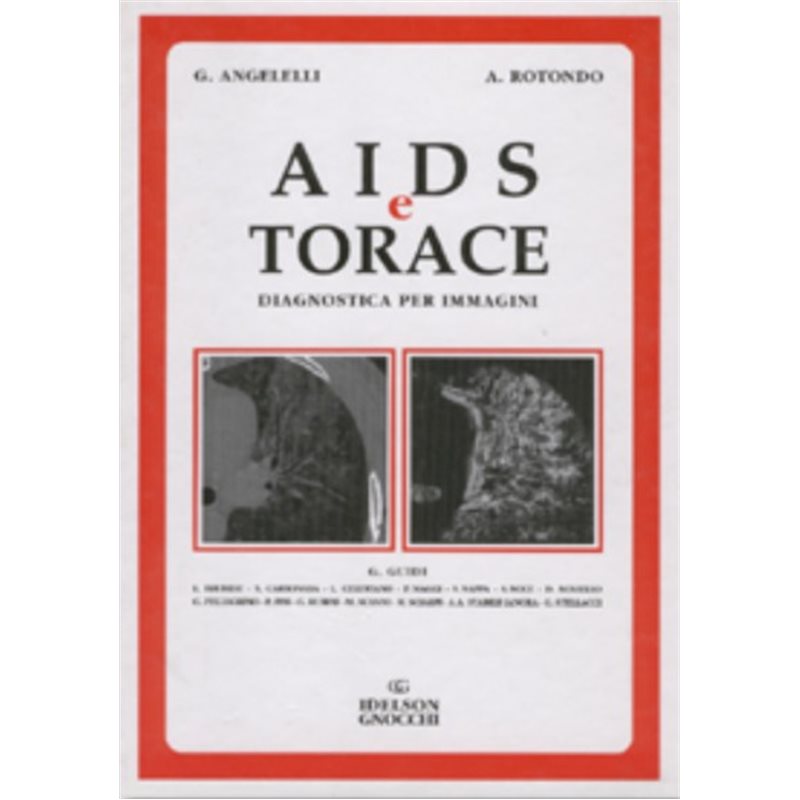 AIDS E TORACE - DIAGNOSTICA PER IMMAGINI